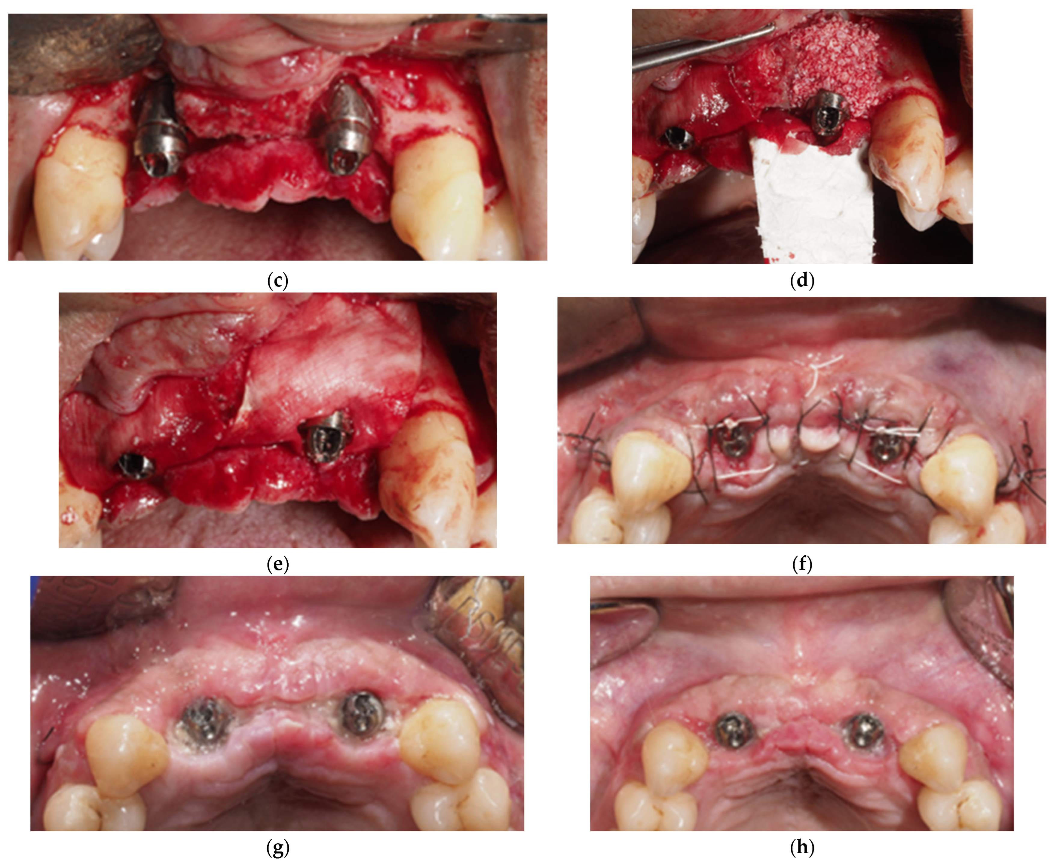 Applsci 15 08040 g002b