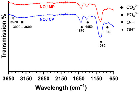 Bone-like Carbonated Apatite Titanium Anodization Coatings