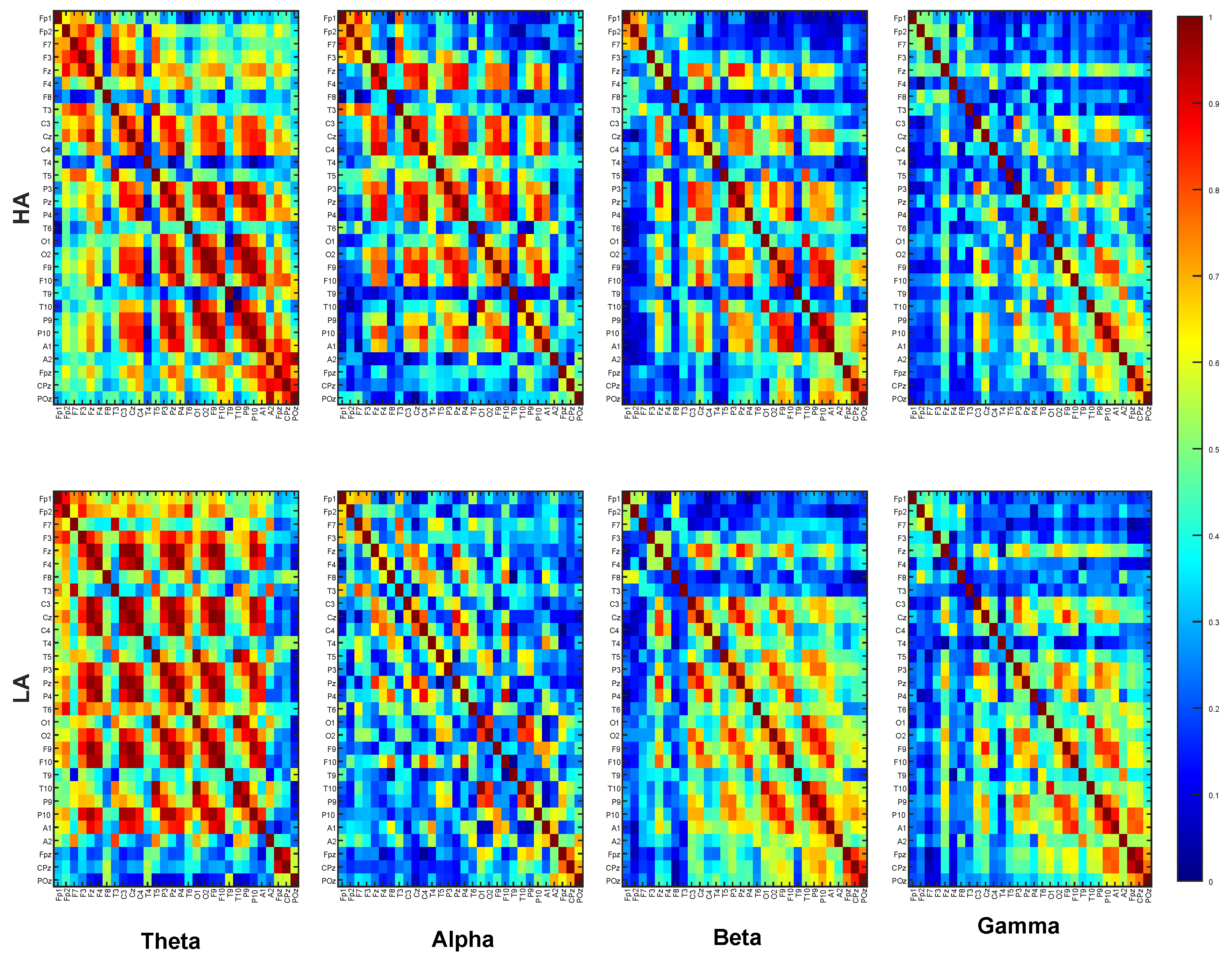 EEG-Based Attention Classification for Enhanced Learning Experience