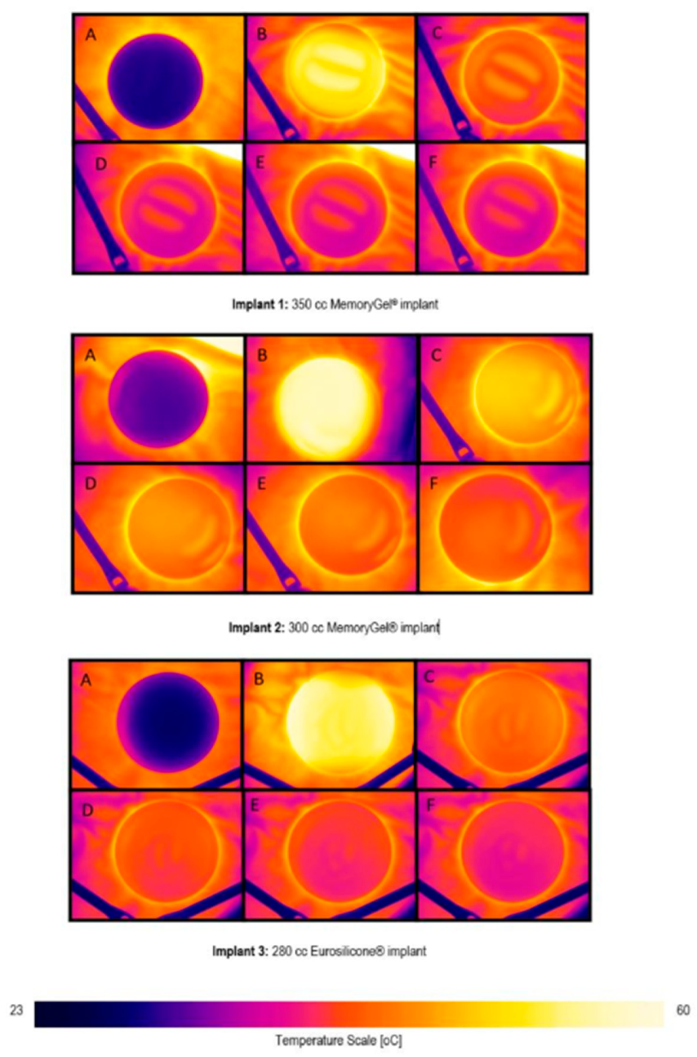 Applsci 15 08831 g006