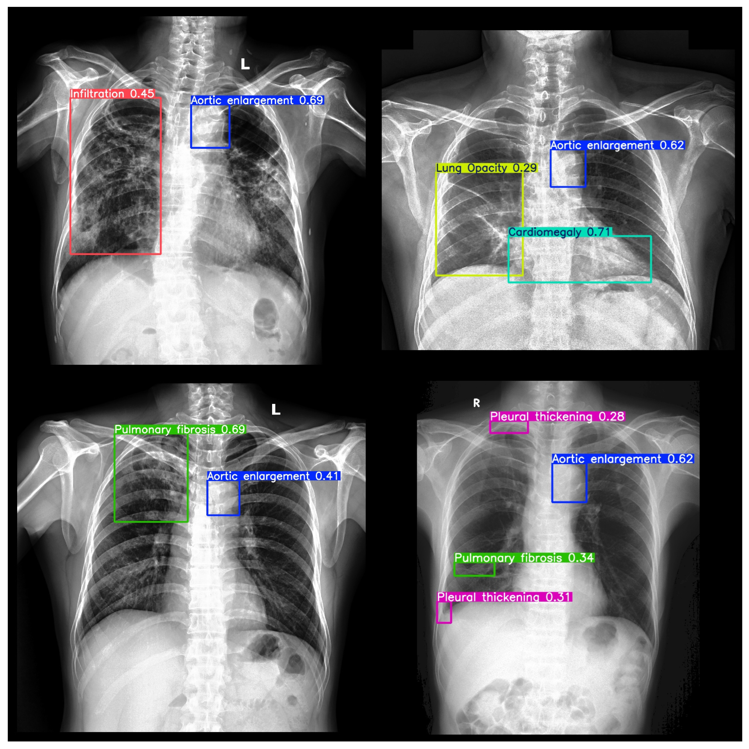 Applsci 15 09345 g003