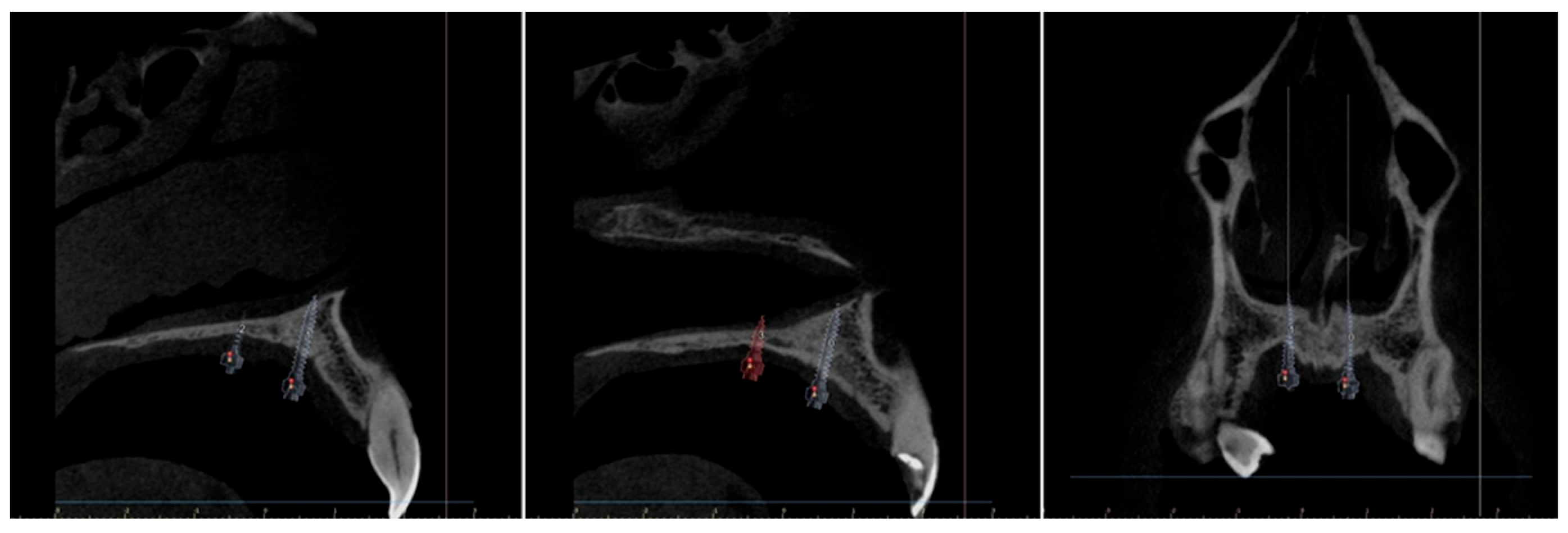 Applsci 15 09511 g007 Applsci 15 09511 g007