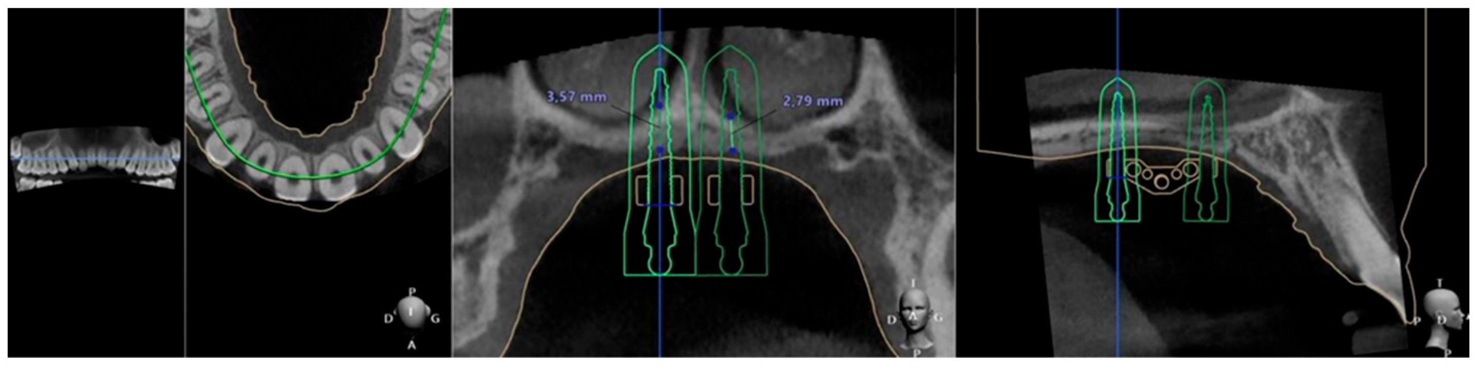 Applsci 15 09511 g009 Applsci 15 09511 g009