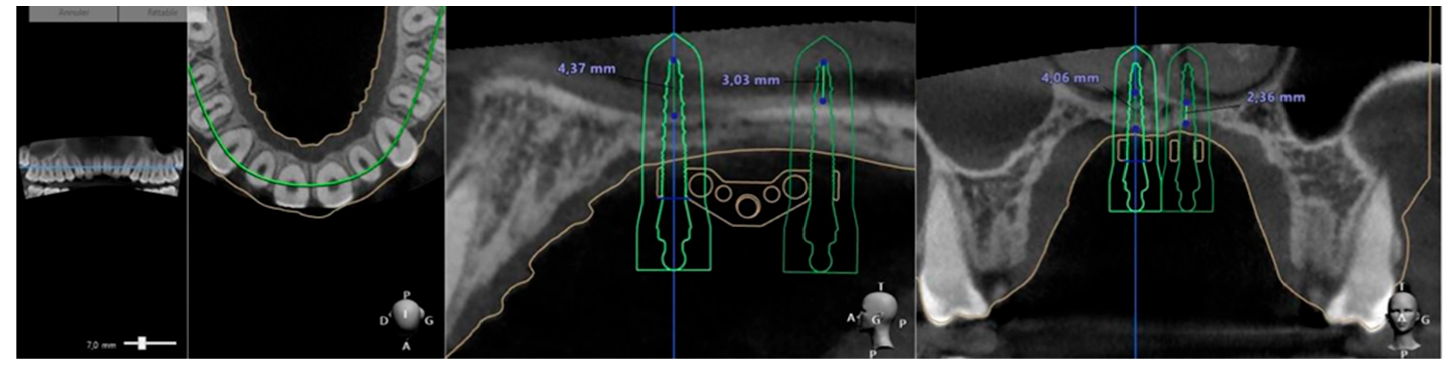 Applsci 15 09511 g010 Applsci 15 09511 g010