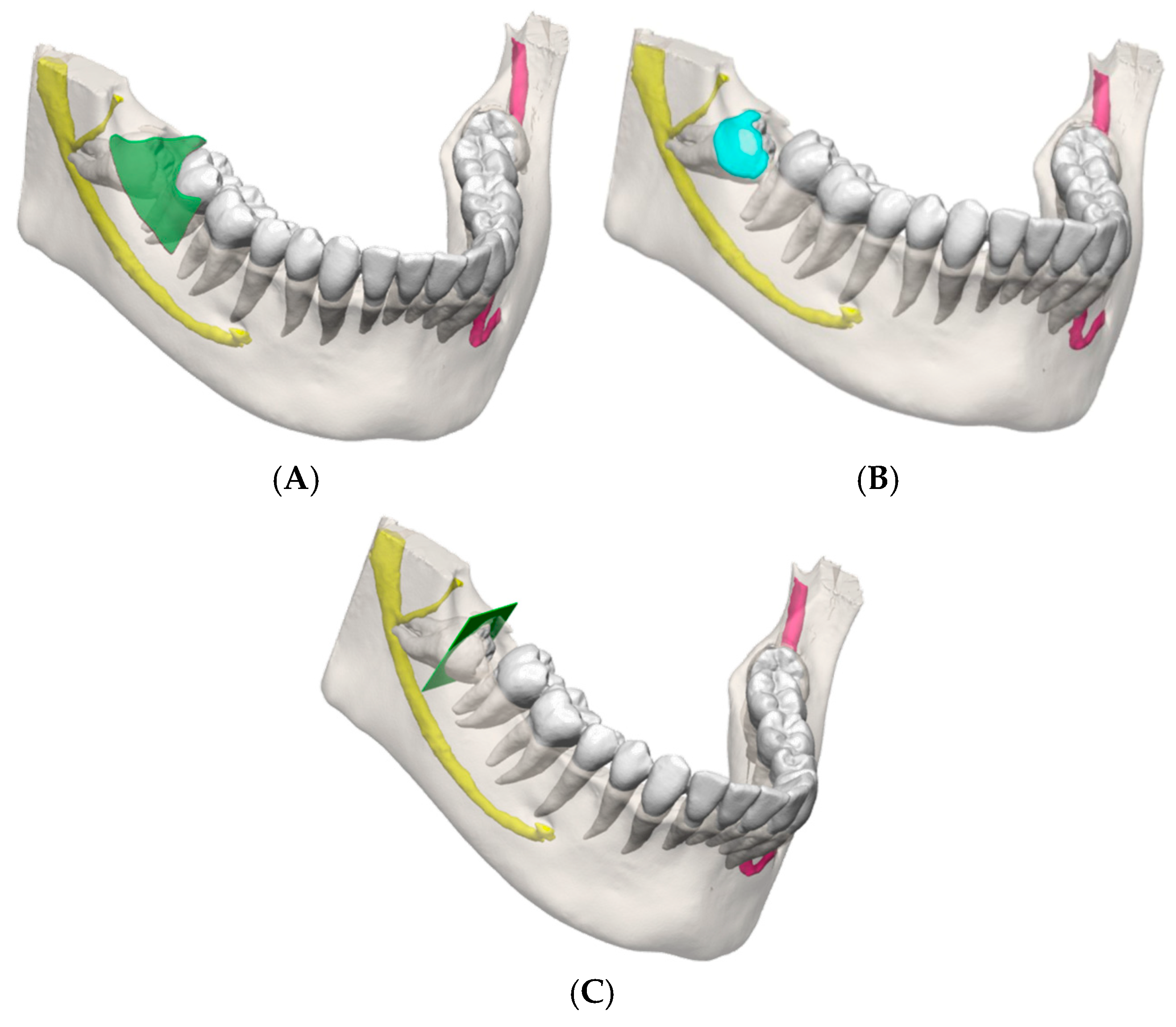Applsci 15 09723 g004 Applsci 15 09723 g004