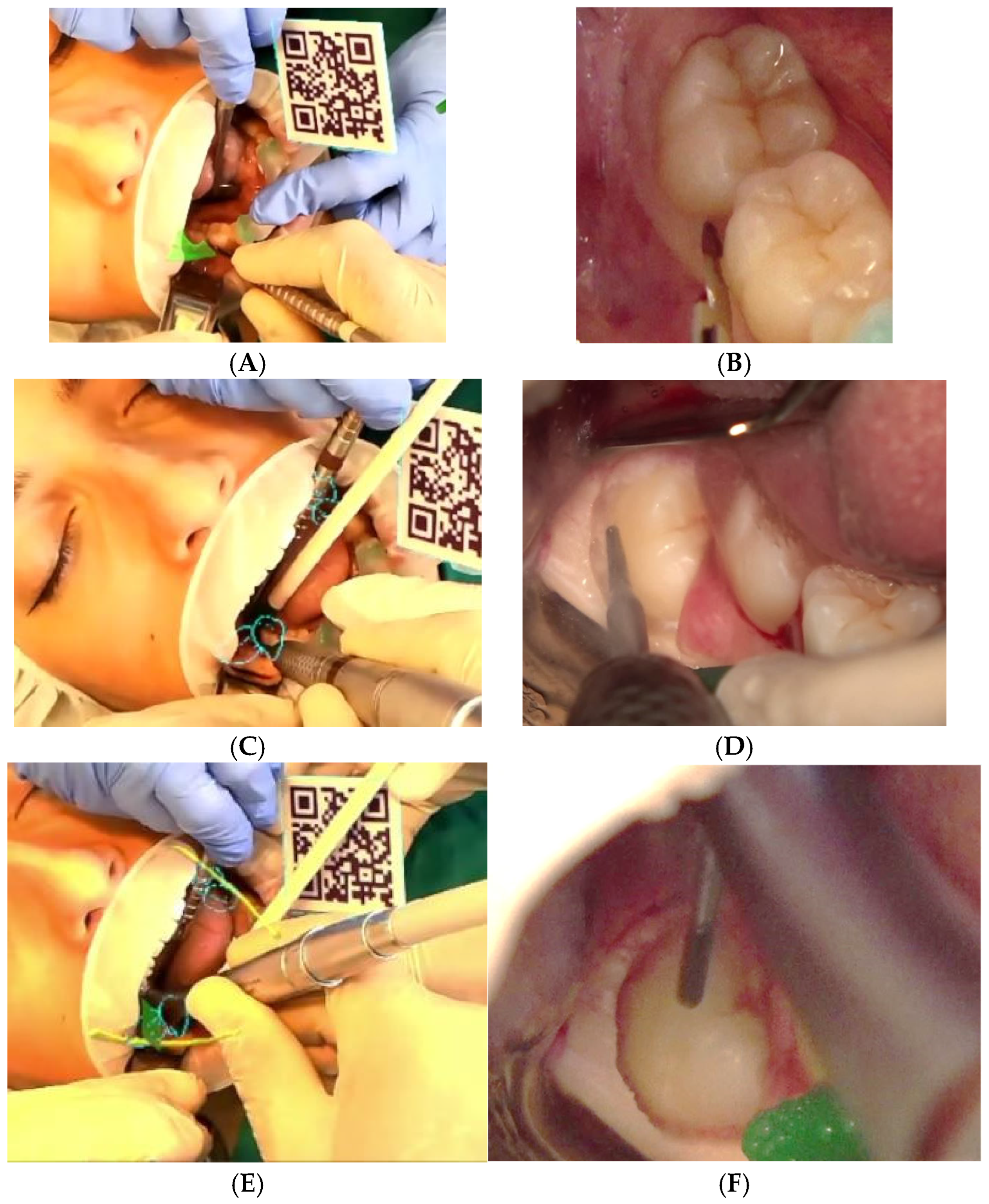 Applsci 15 09723 g005a Applsci 15 09723 g005a