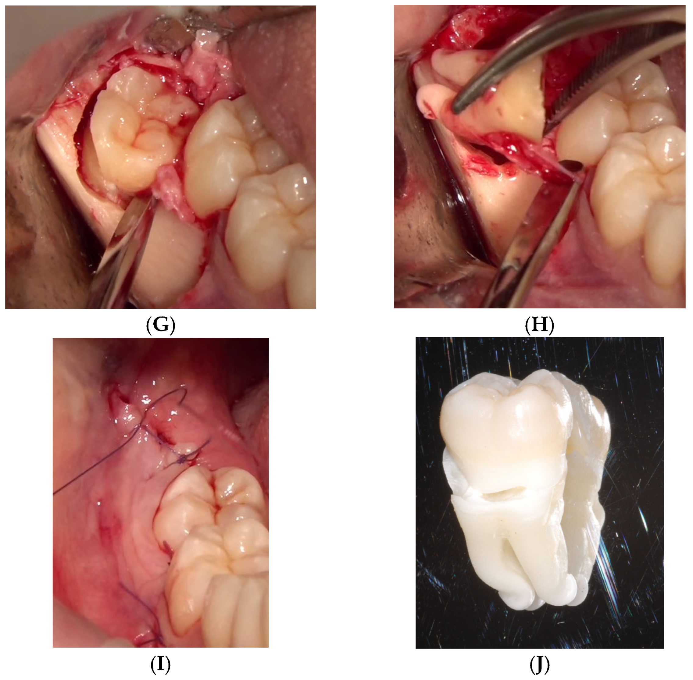 Applsci 15 09723 g005b Applsci 15 09723 g005b