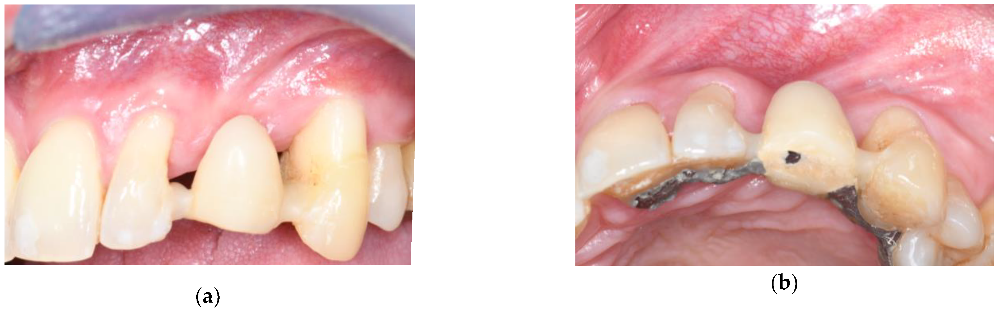 Applsci 15 10178 g001a