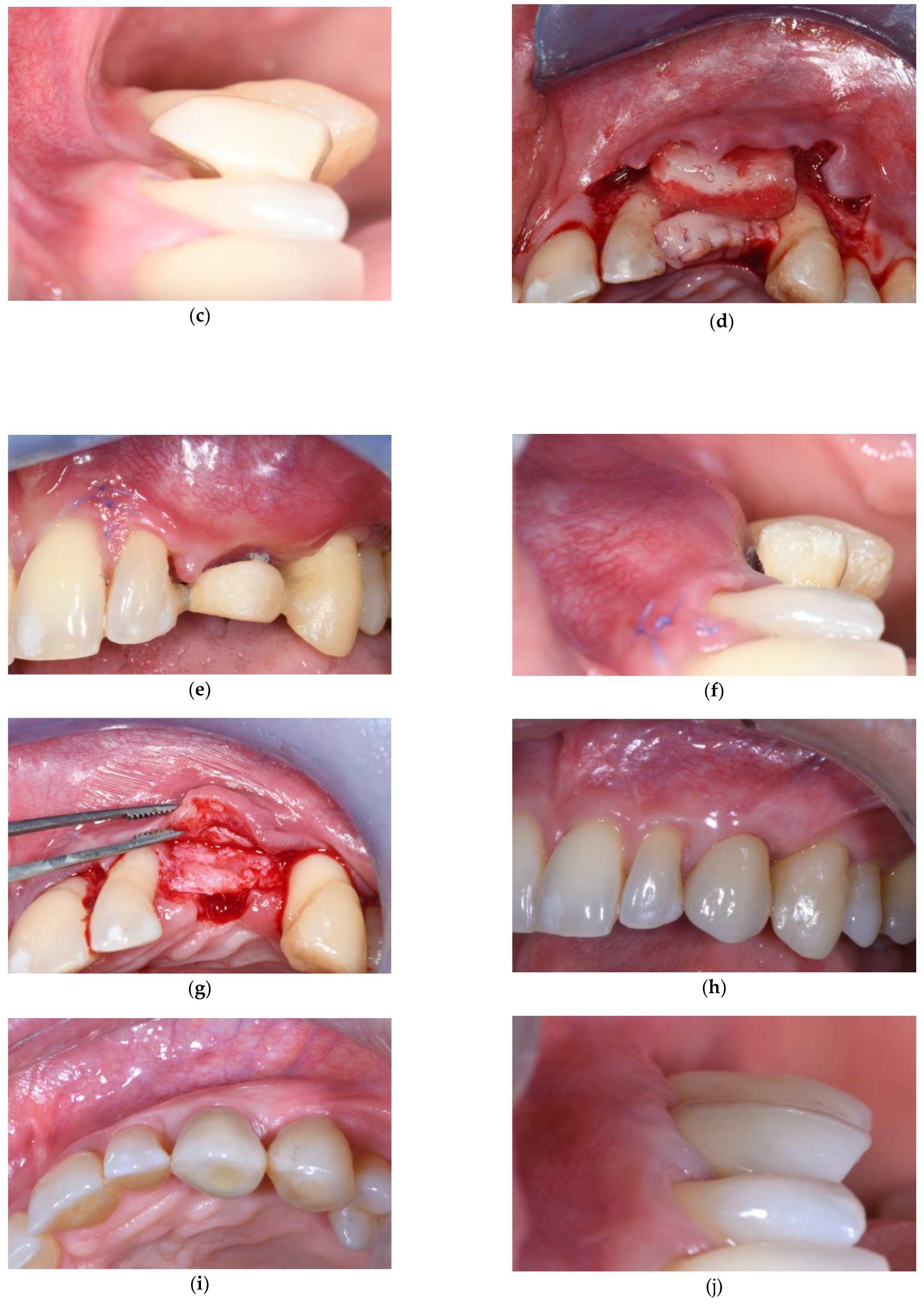 Applsci 15 10178 g001b