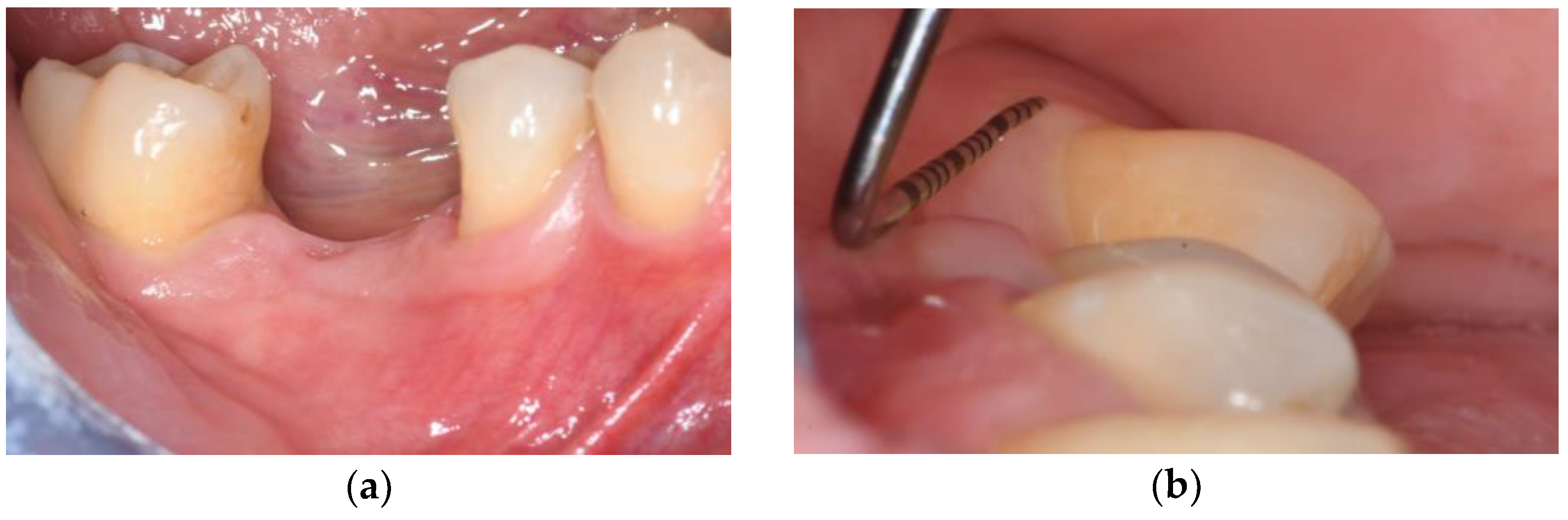 Applsci 15 10178 g002a