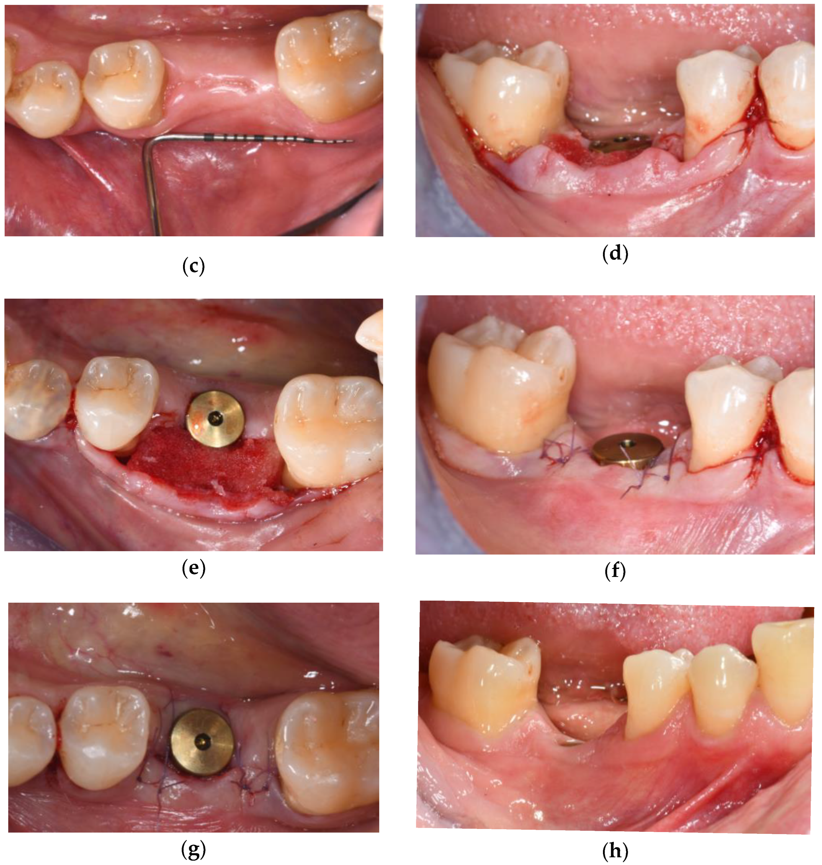 Applsci 15 10178 g002b