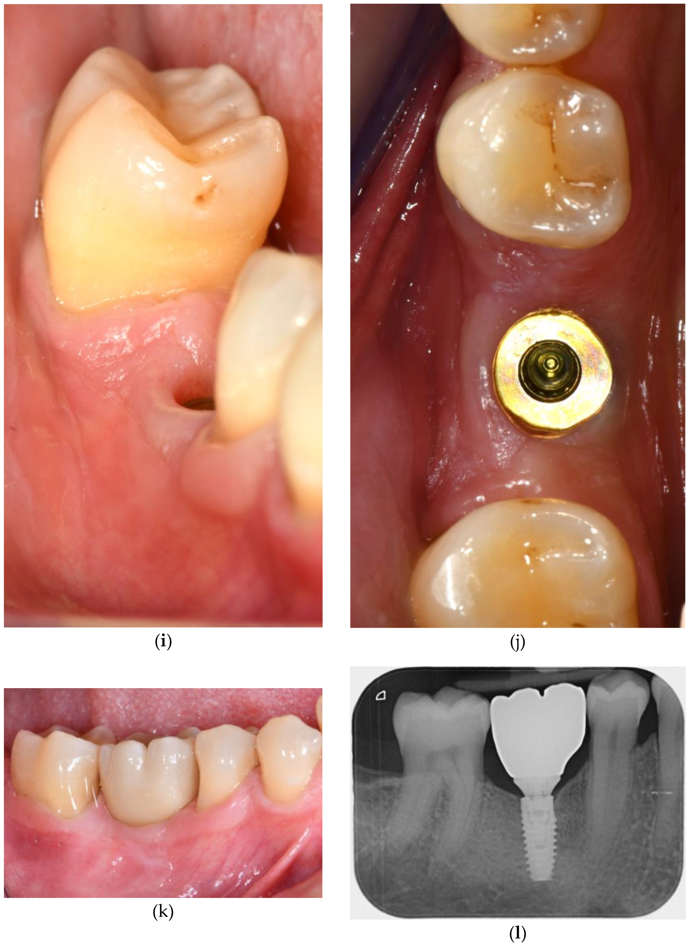 Applsci 15 10178 g002c