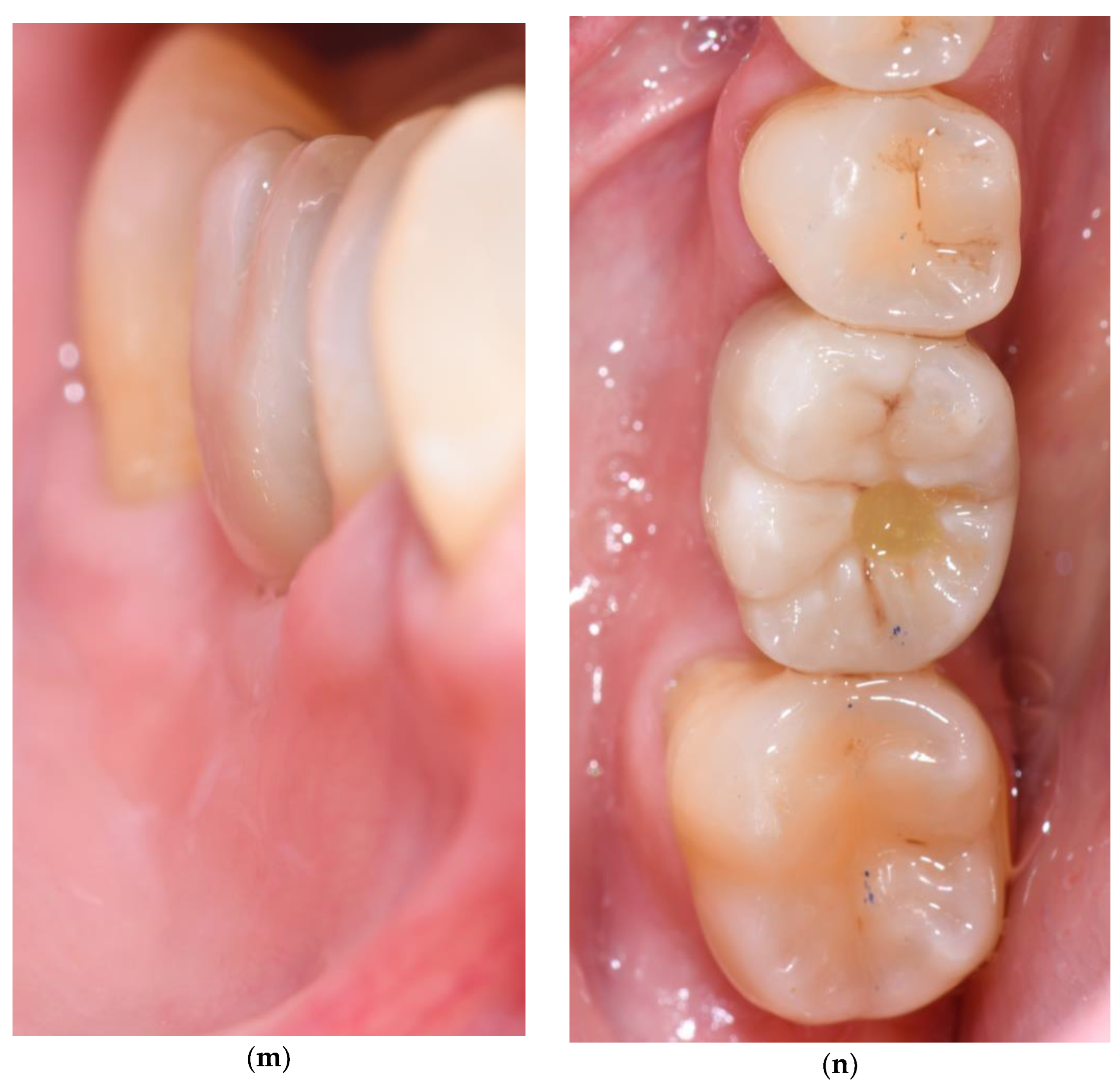 Applsci 15 10178 g002d