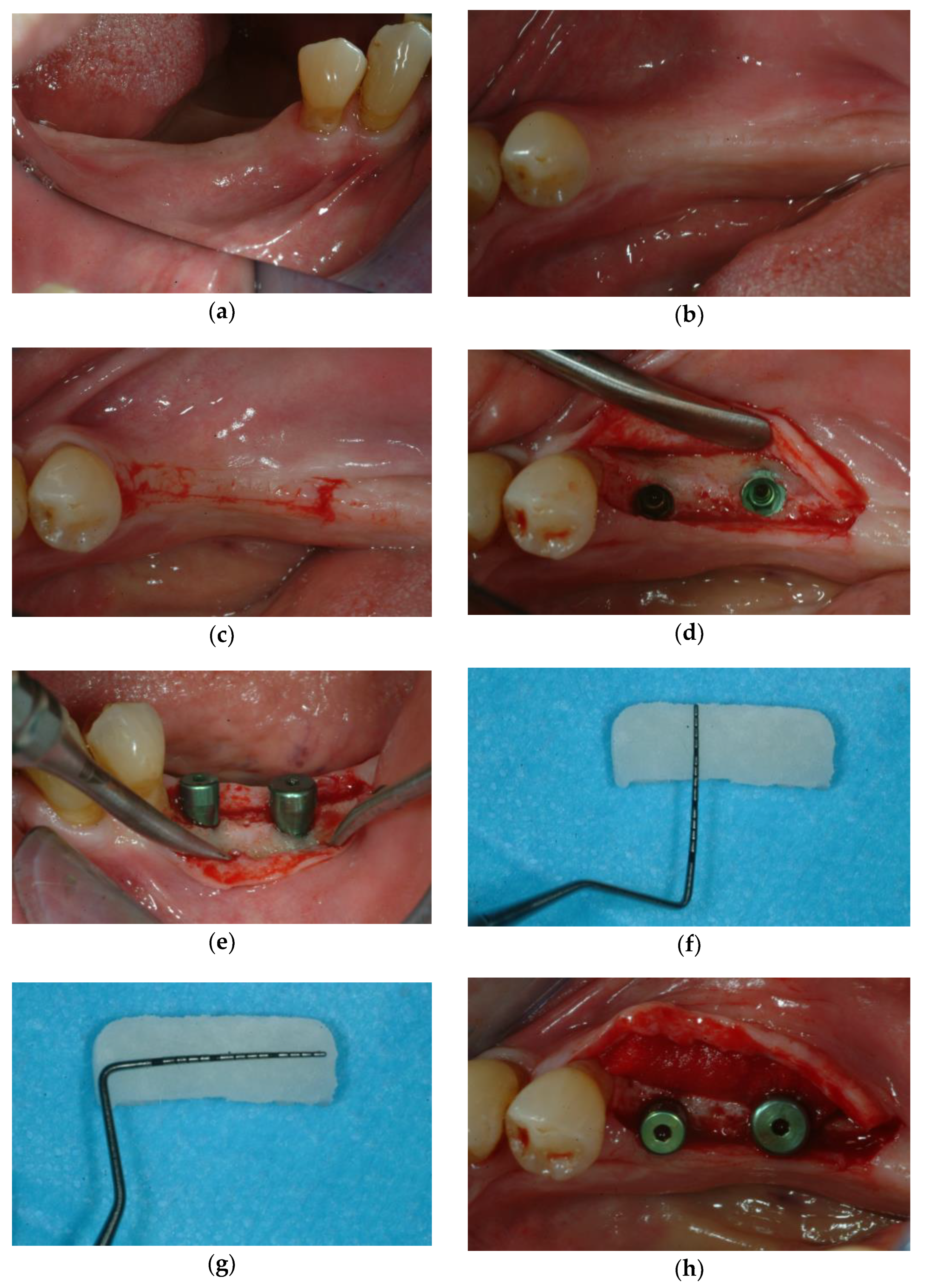 Applsci 15 10178 g003a