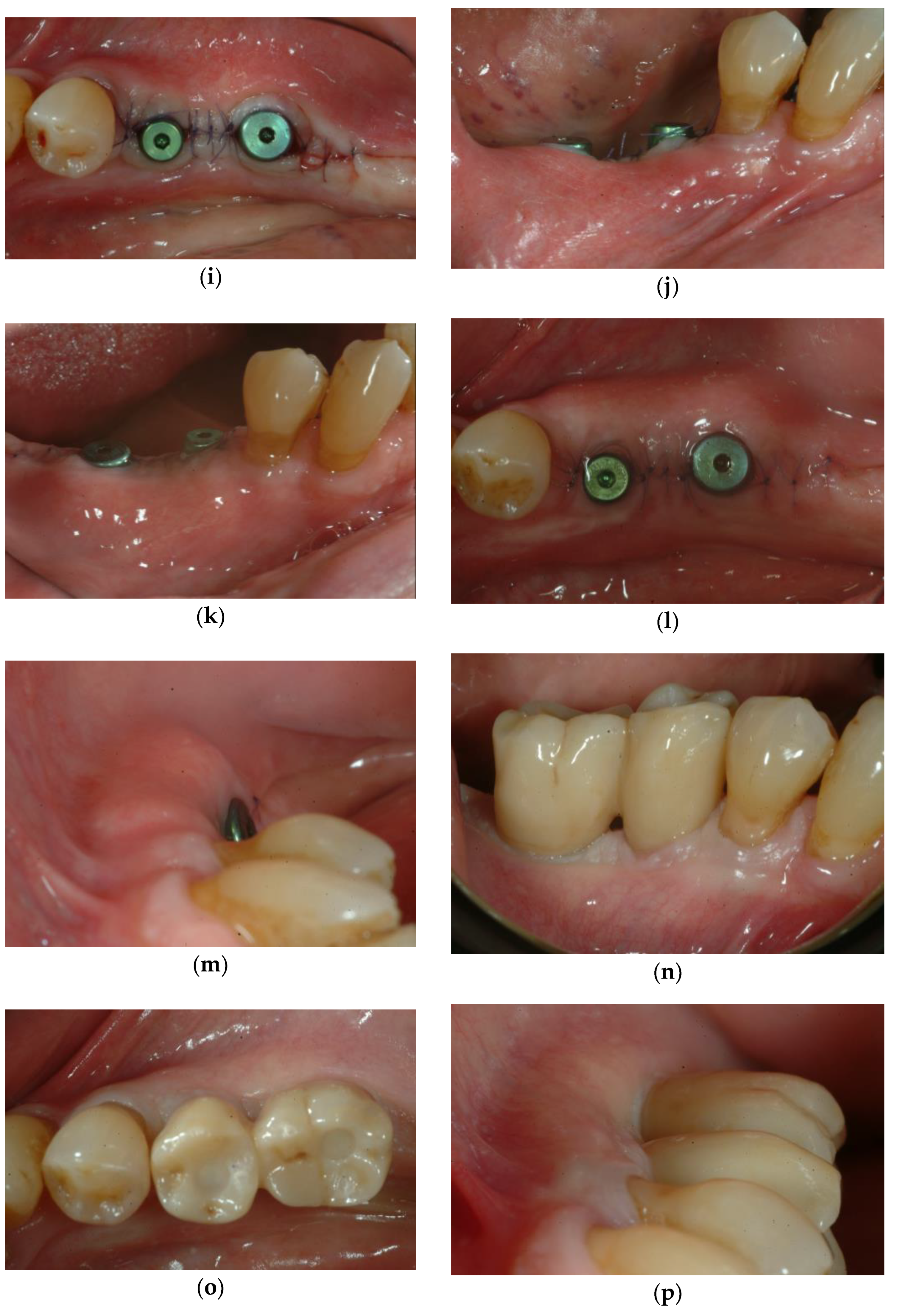 Applsci 15 10178 g003b