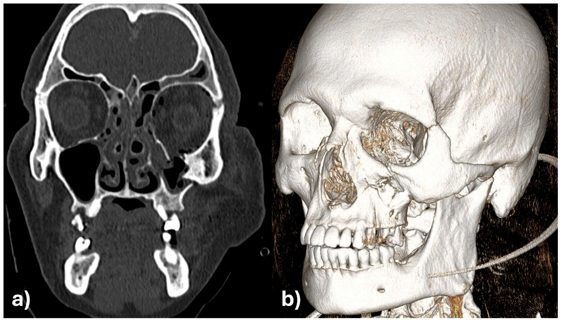 Applsci 15 10194 g001