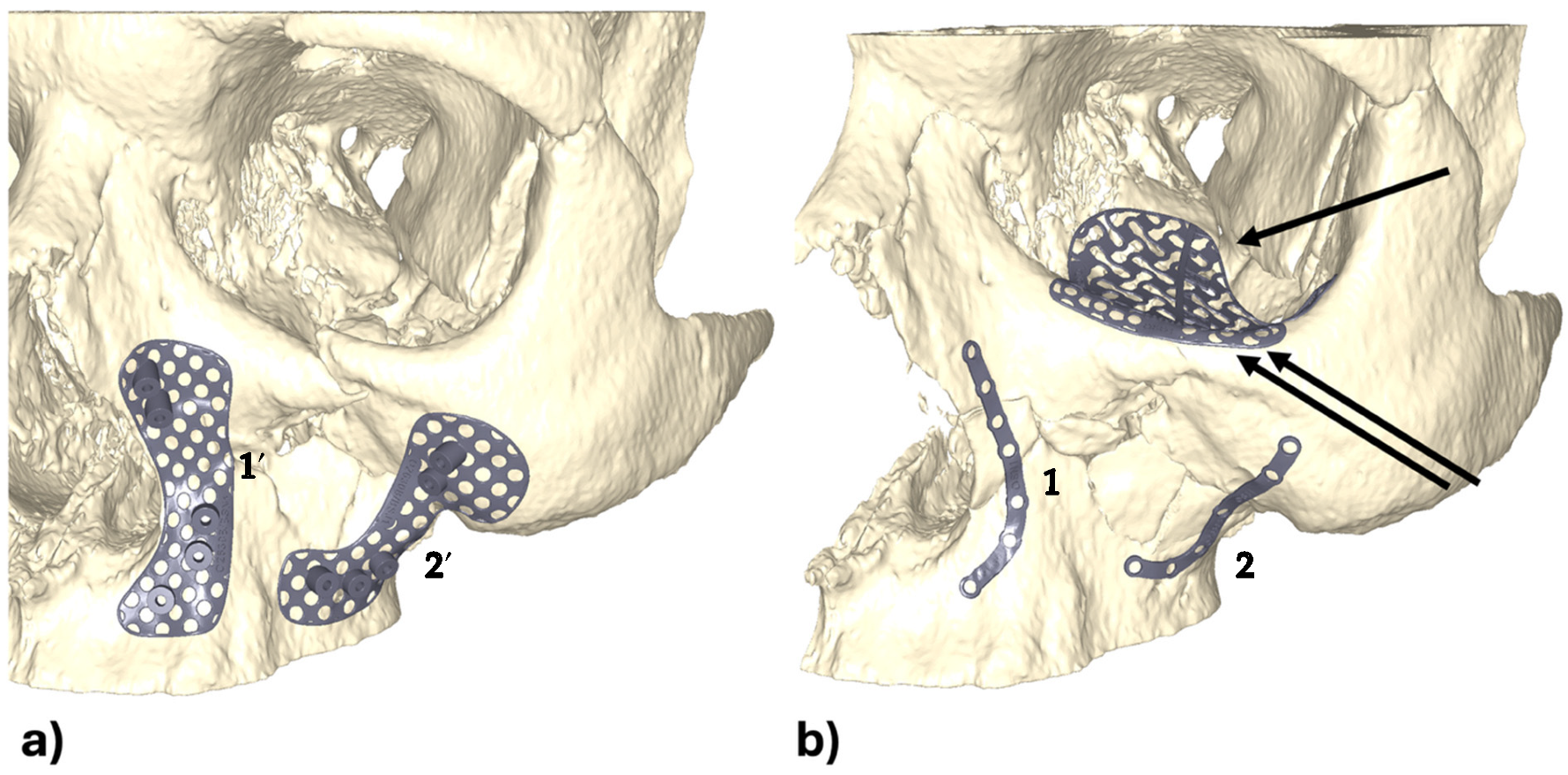 Applsci 15 10194 g003