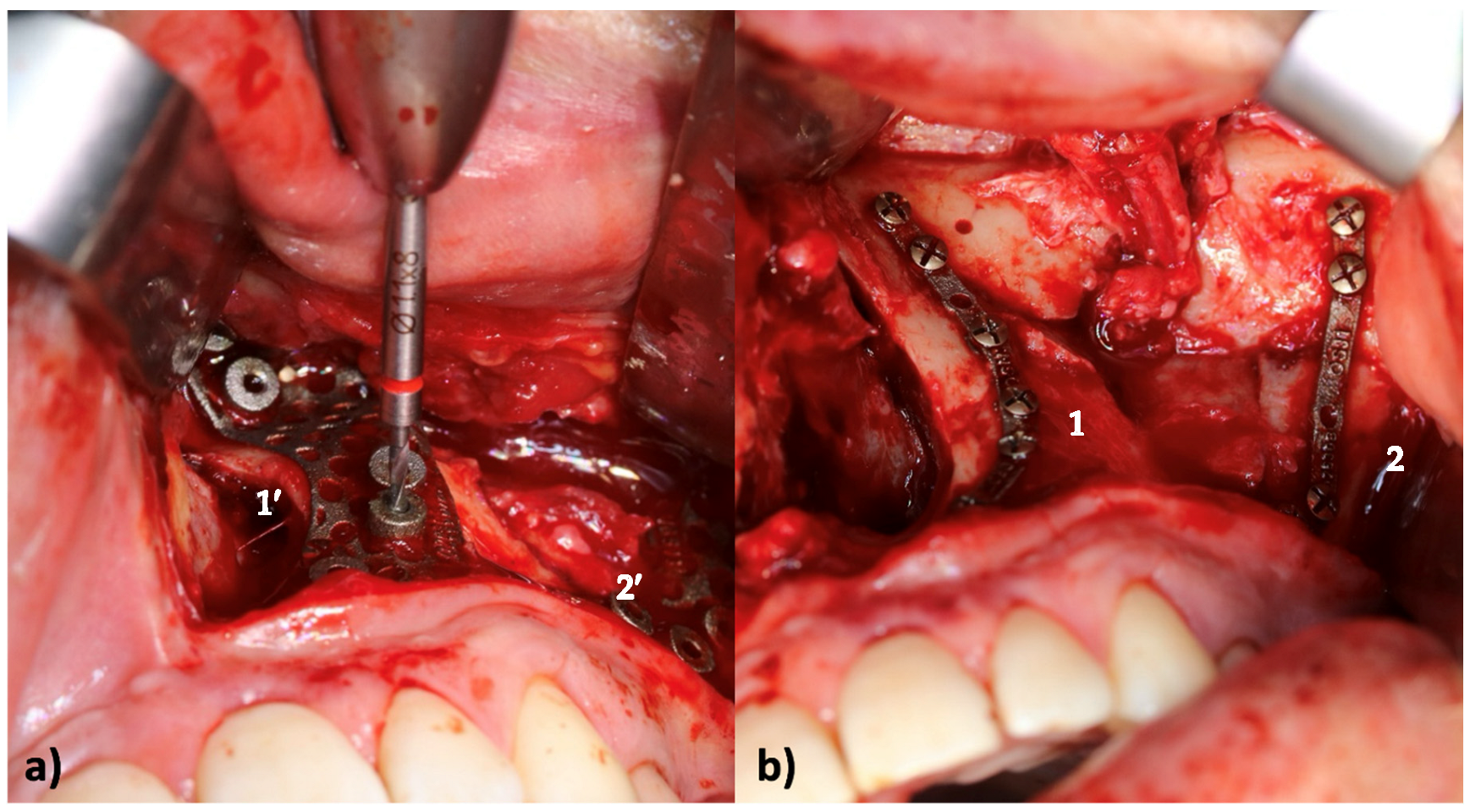 Applsci 15 10194 g004