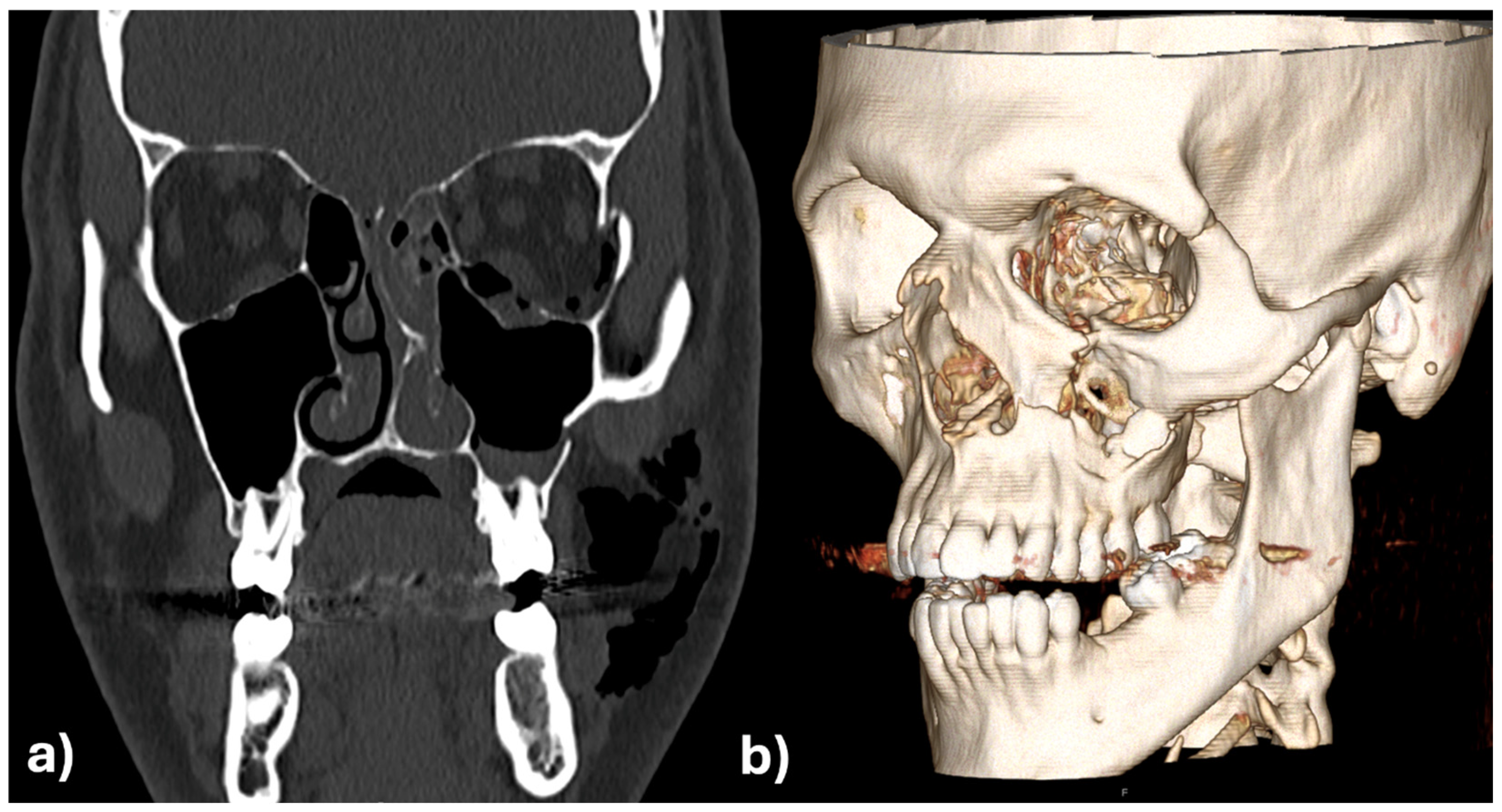 Applsci 15 10194 g007