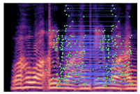 Applsci 15 11845 i004