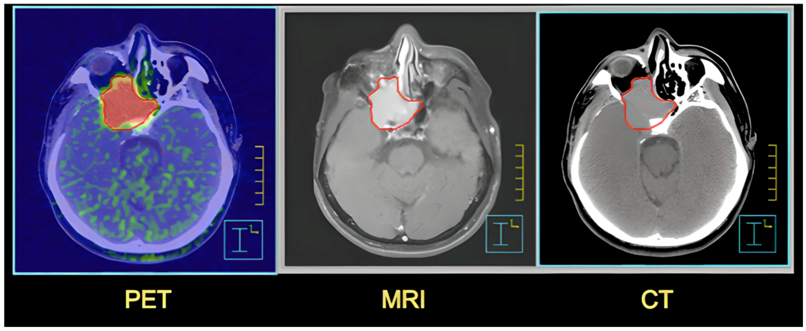 Applsci 15 12579 g006