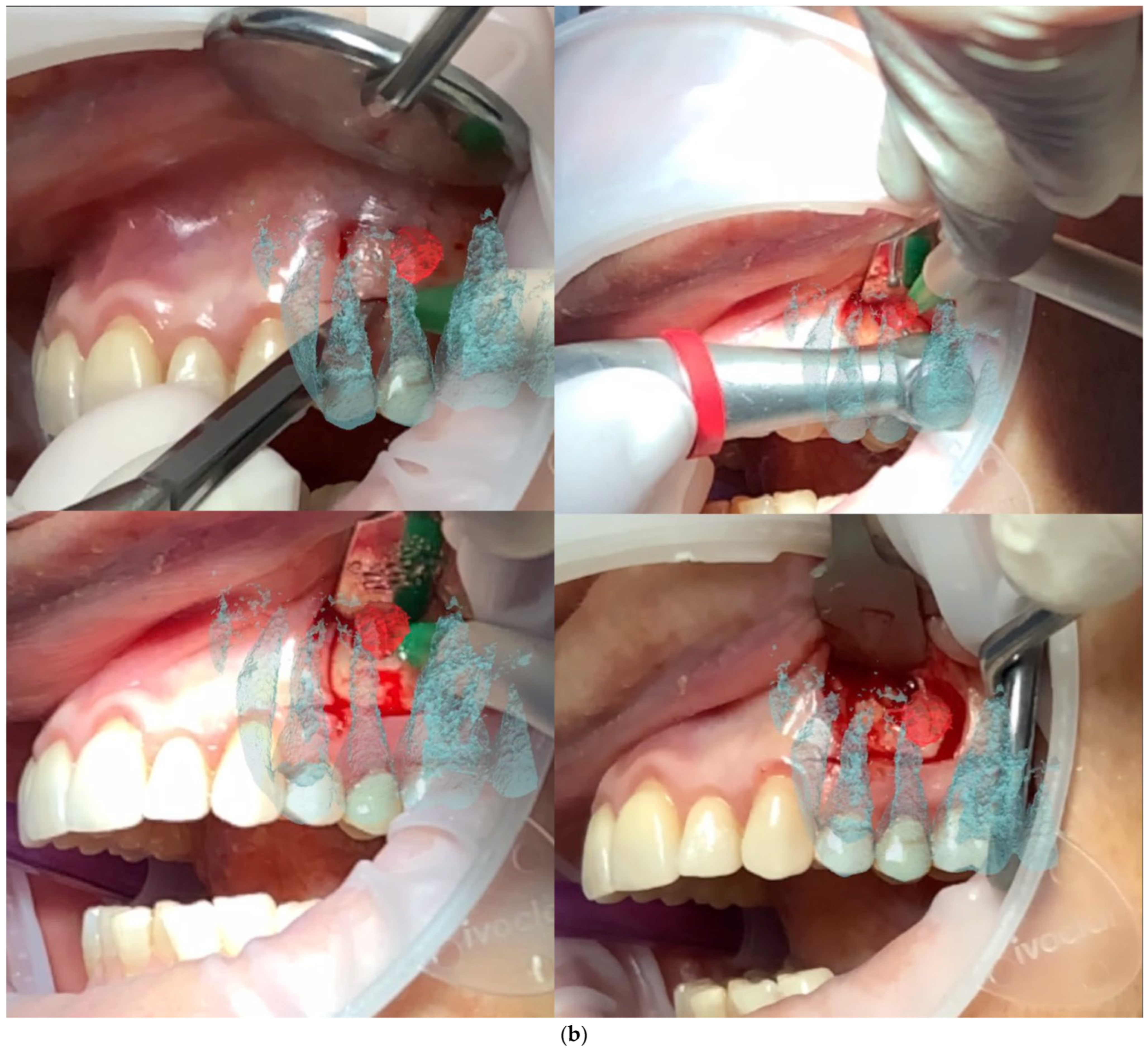 Applsci 15 12588 g003b