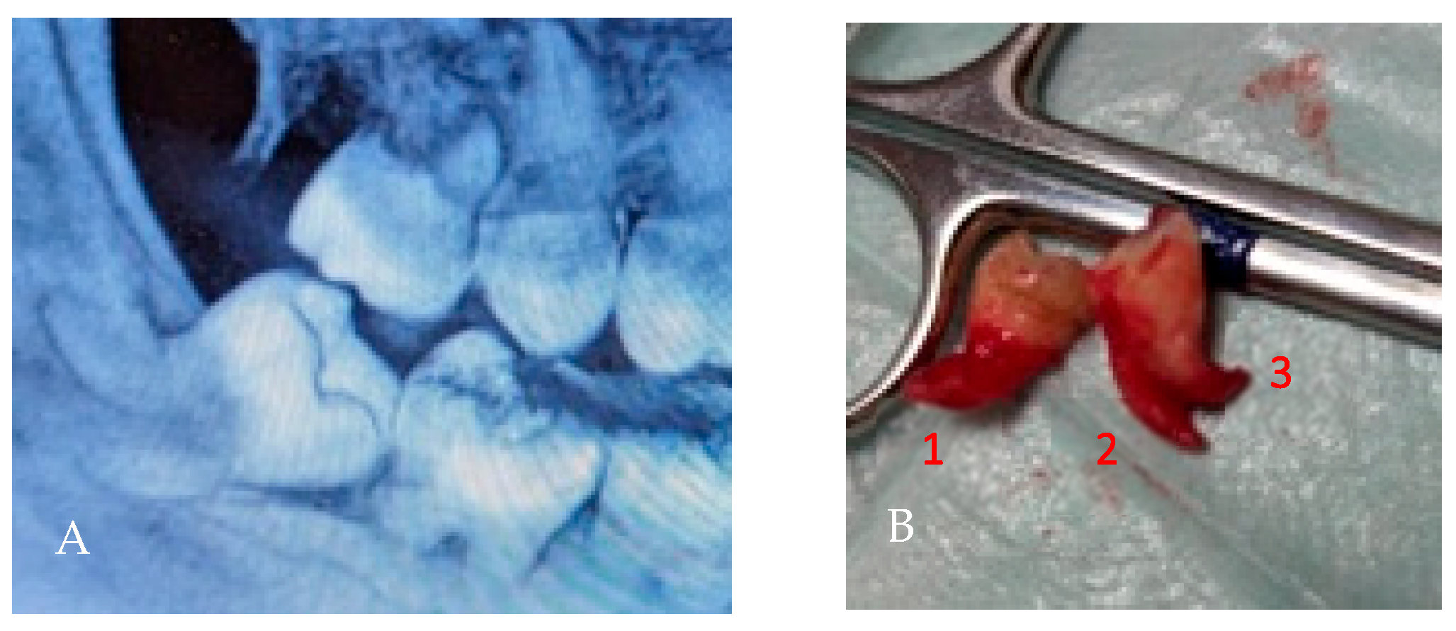 Applsci 15 12756 g014 Applsci 15 12756 g014