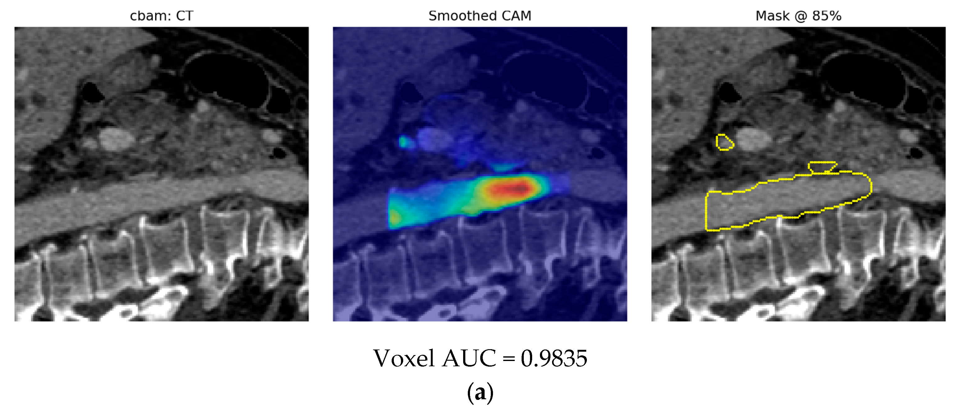 Applsci 15 13024 g014a