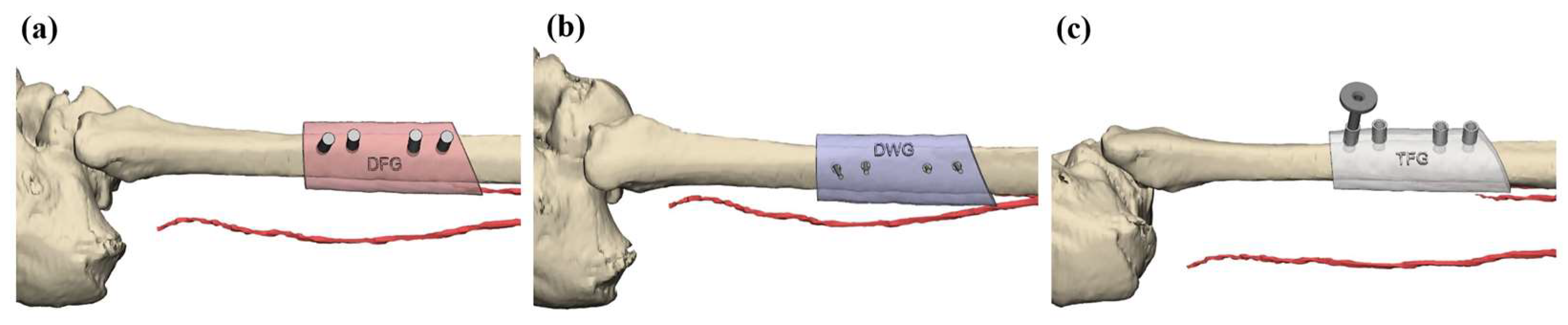 Applsci 15 13144 g001