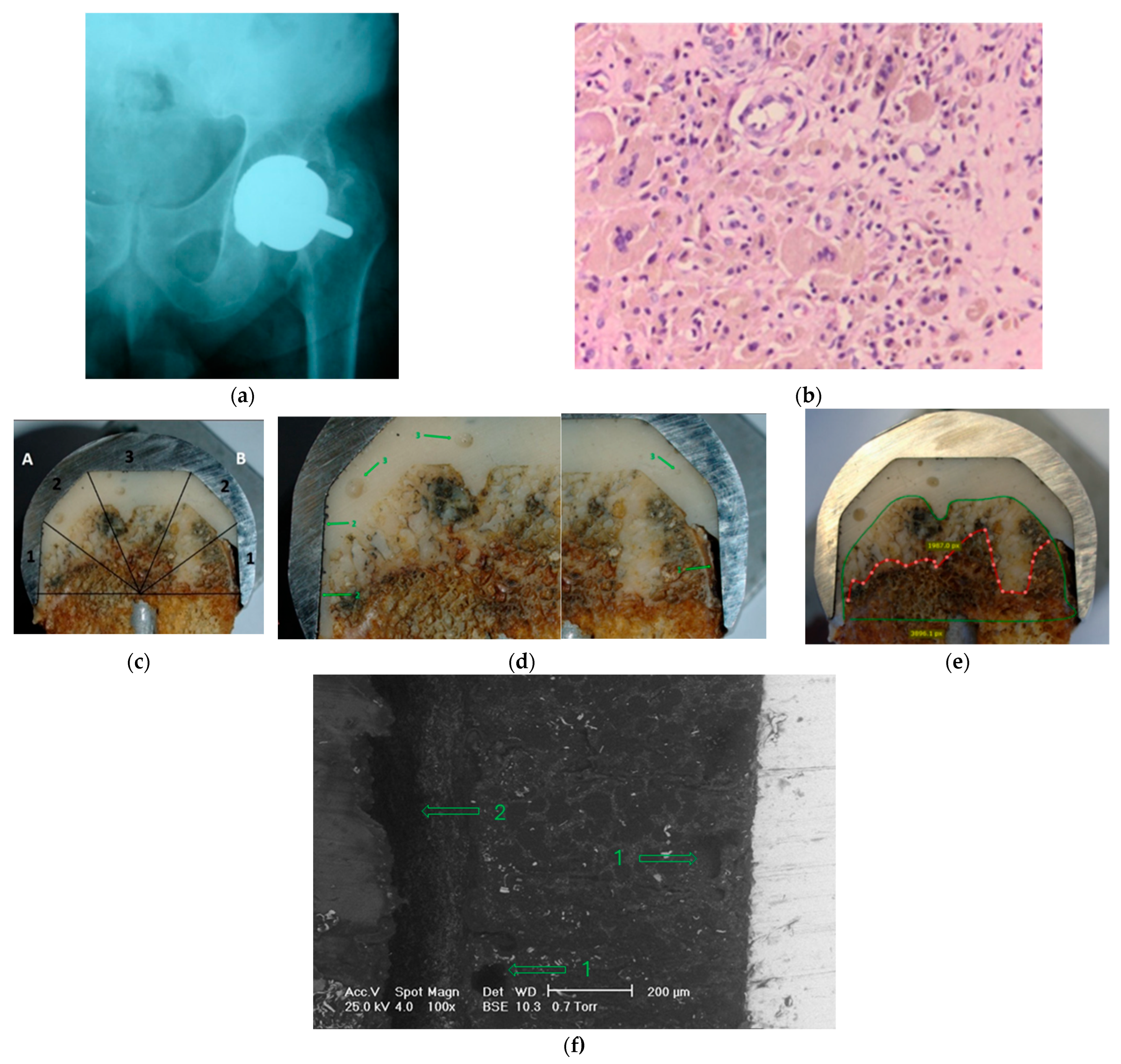 Applsci 16 03045 g005