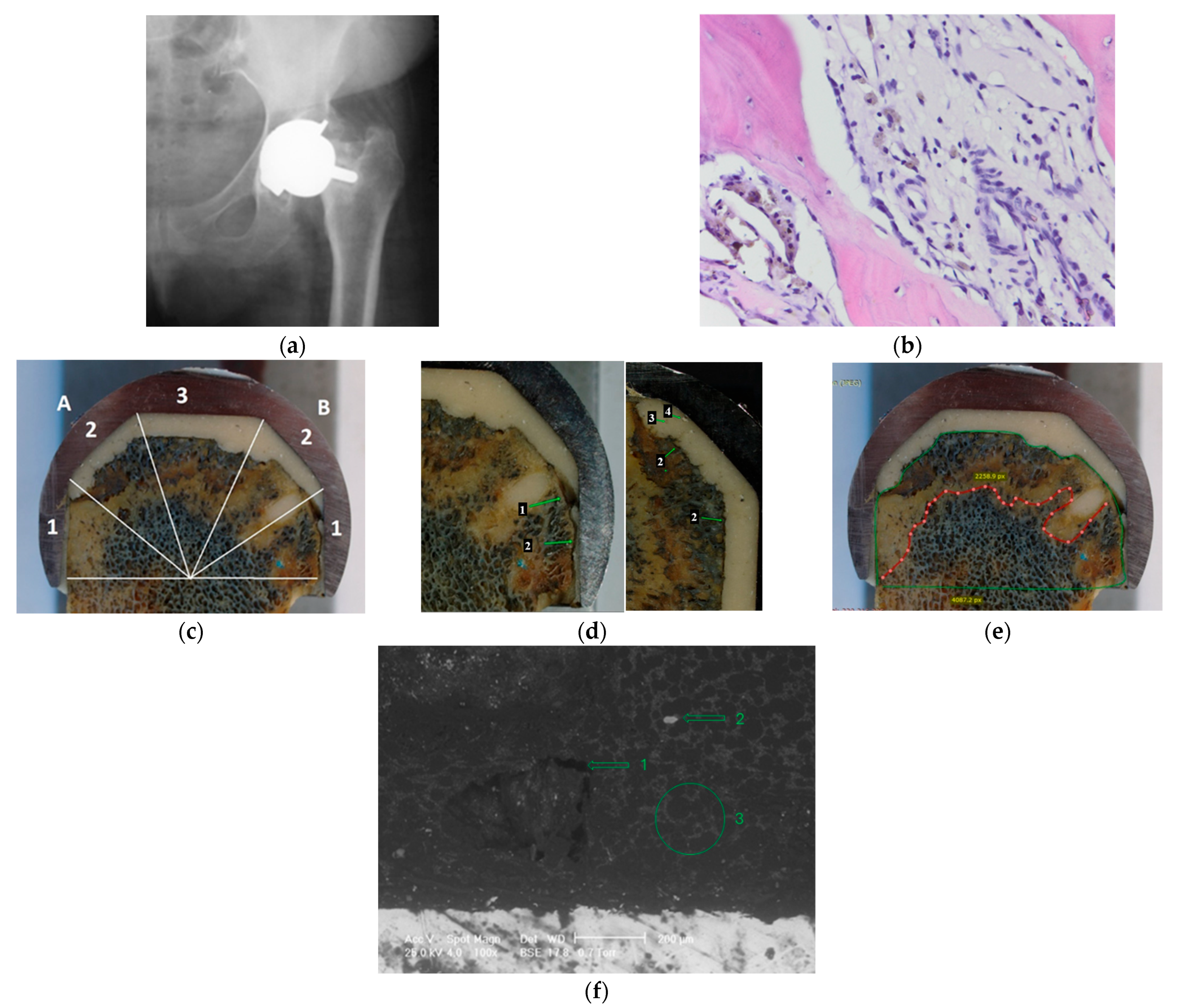 Applsci 16 03045 g006