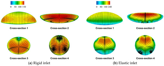 Aeroelastic Effects on the Internal Flow Characteristics and