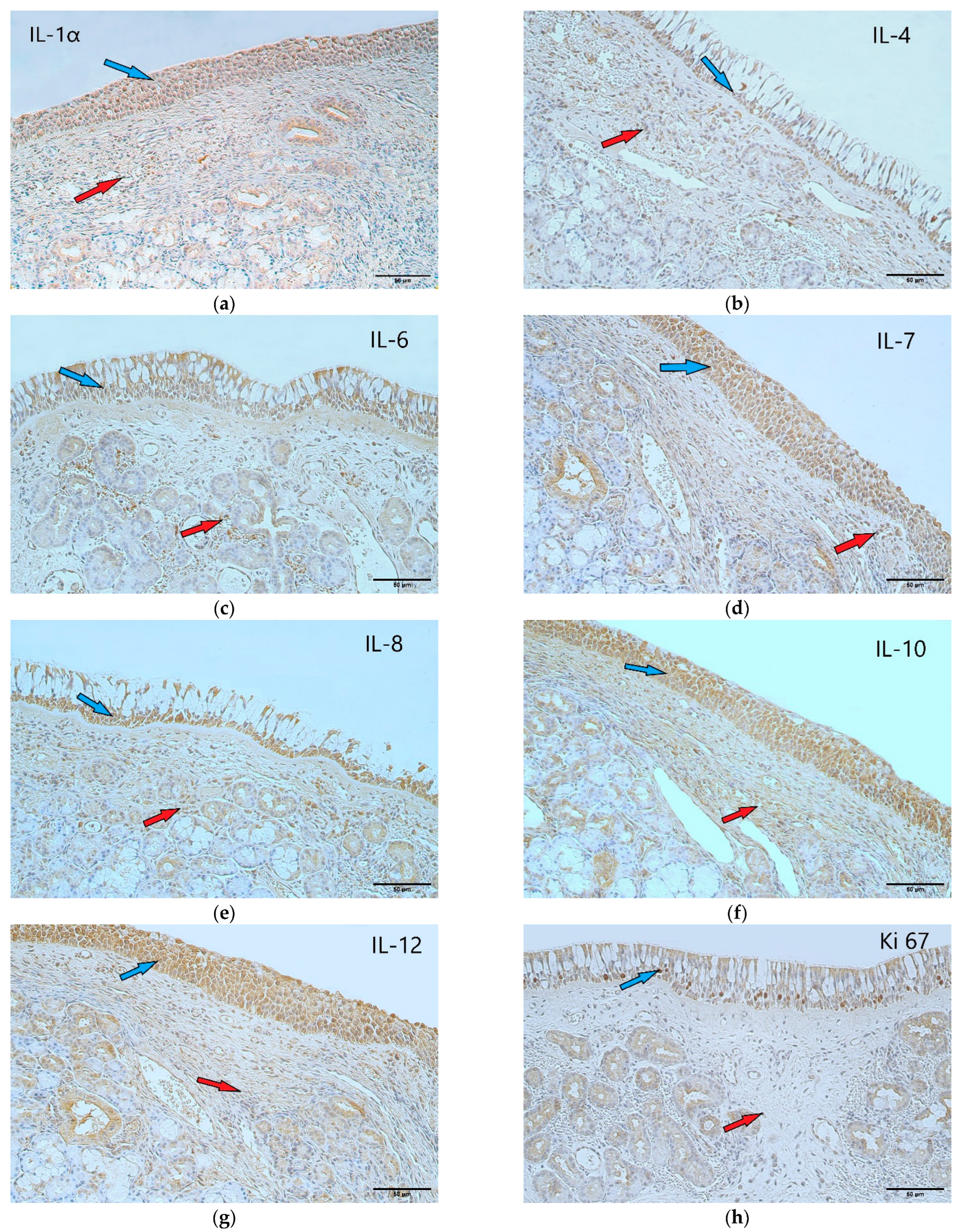 Arm 90 00053 g003 Arm 90 00053 g003