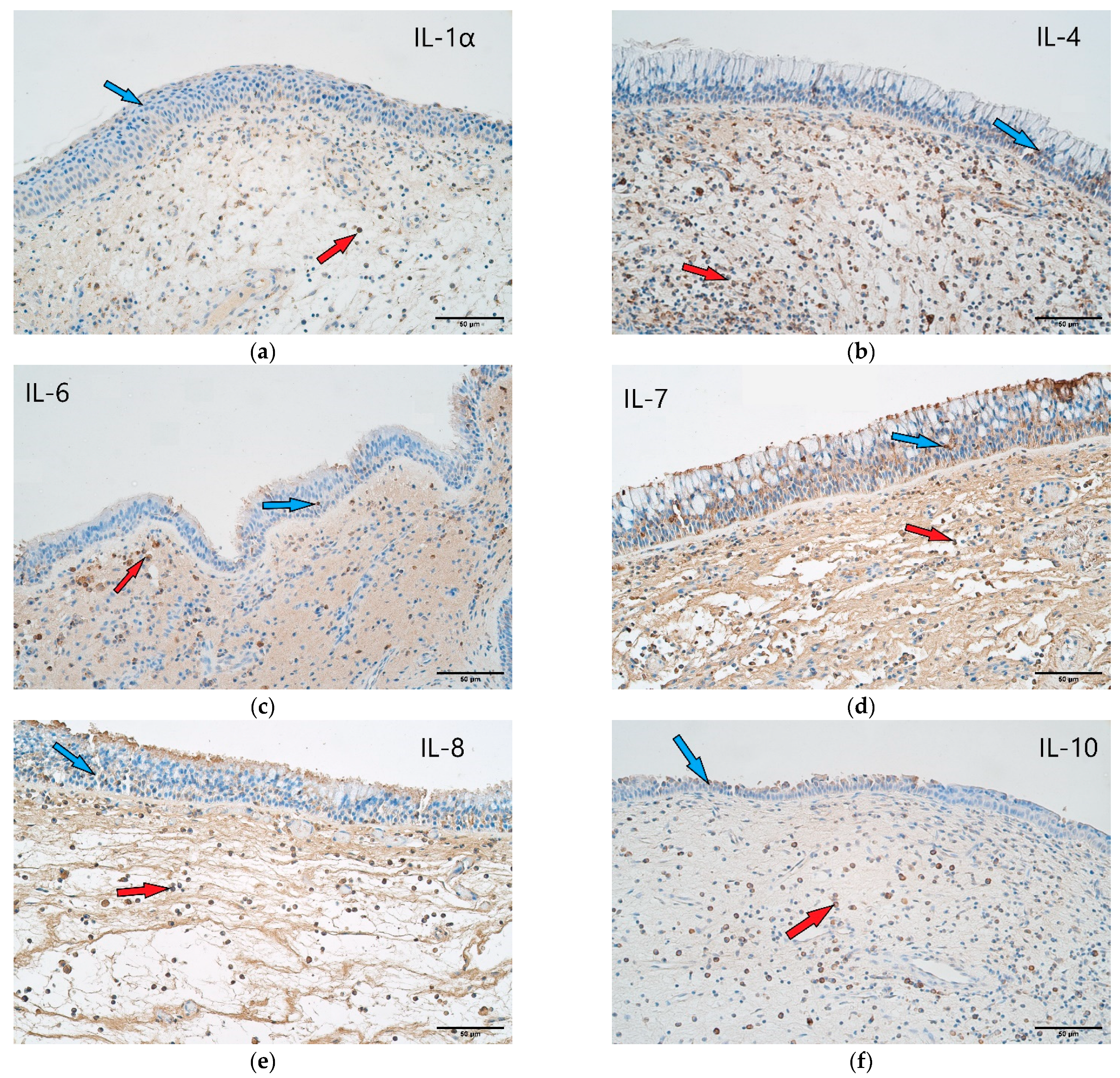 Arm 90 00053 g004a Arm 90 00053 g004a