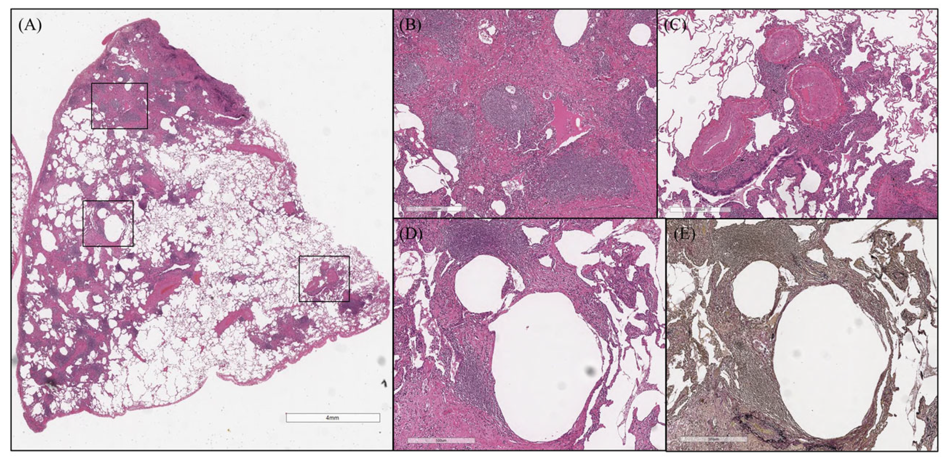 Arm 91 00014 g004 Arm 91 00014 g004