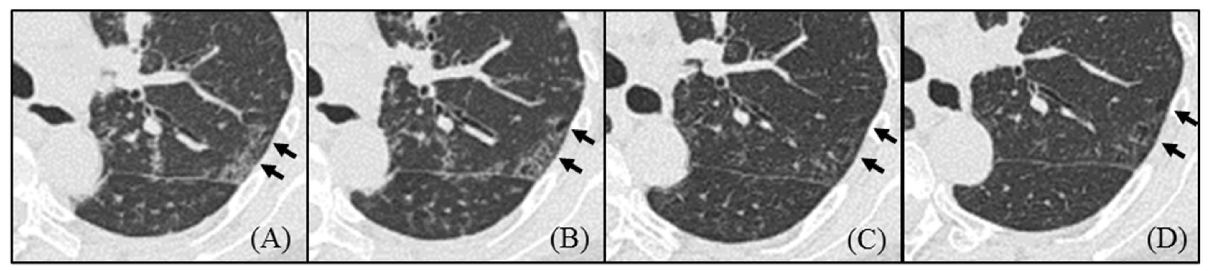 Arm 91 00014 g005 Arm 91 00014 g005