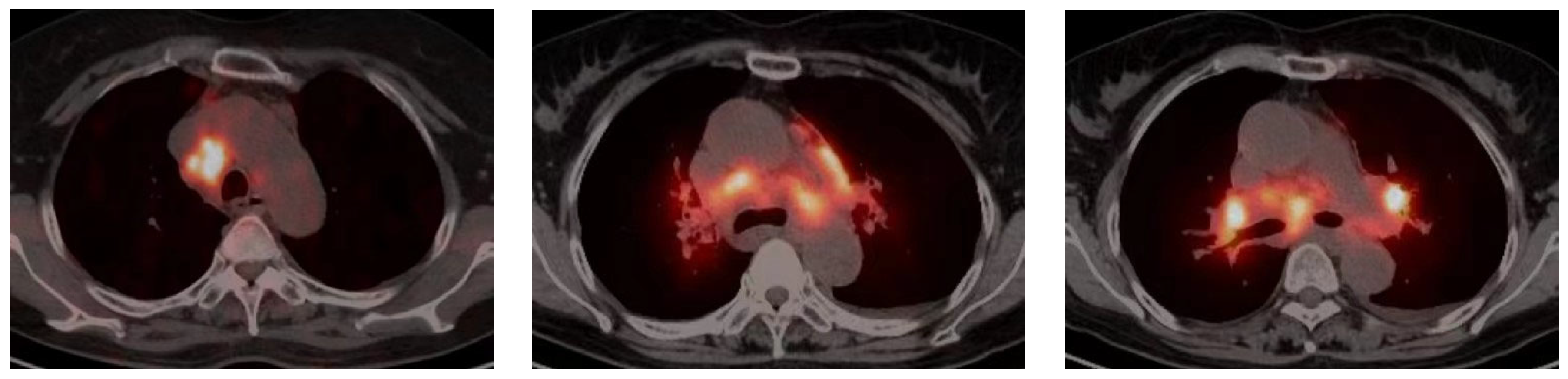 Arm 92 00020 g001 Arm 92 00020 g001