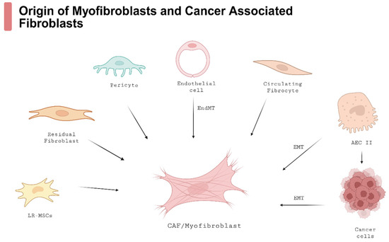 Concomitant Idiopathic Pulmonary Fibrosis and Lung Cancer: An