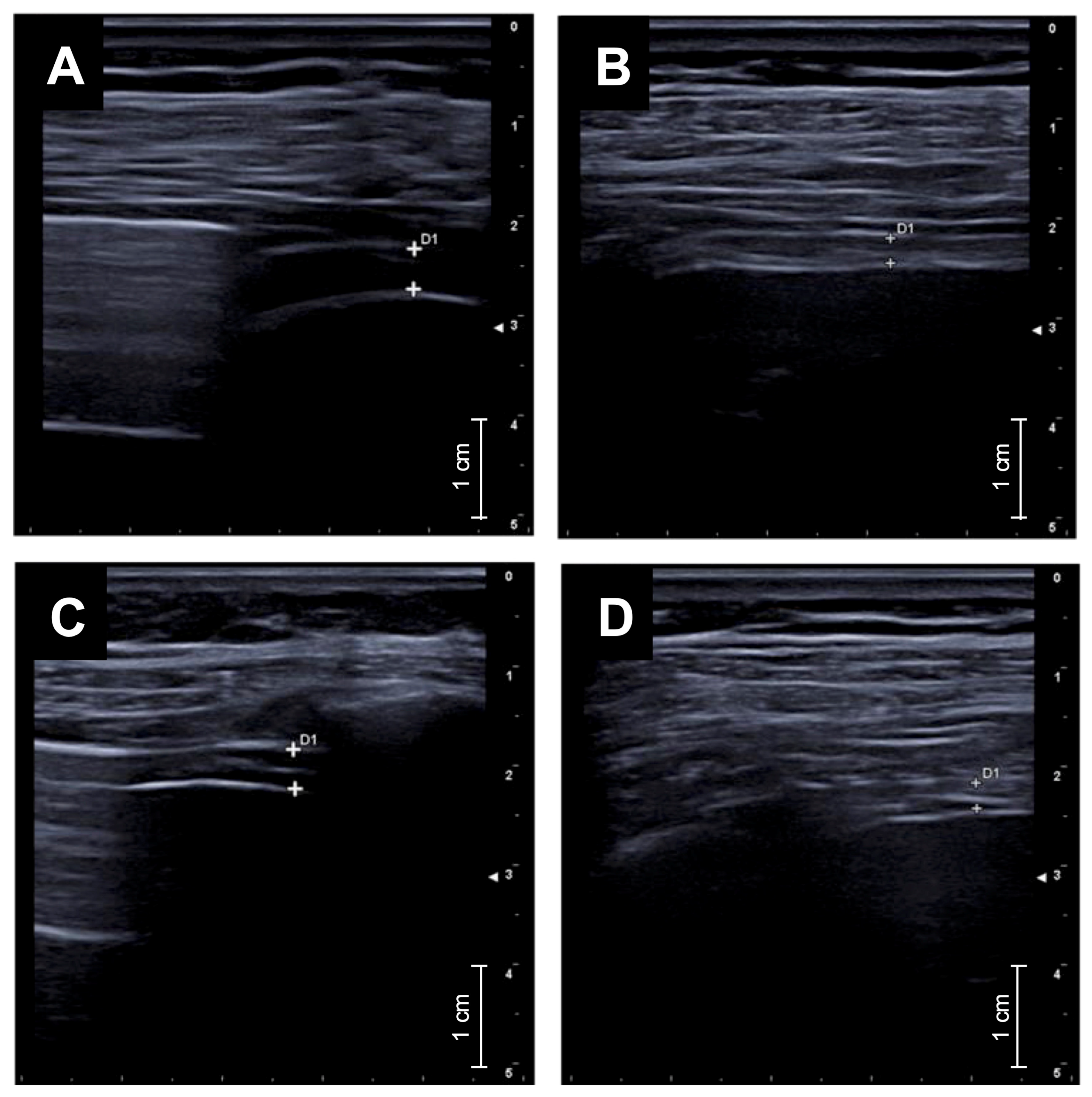 Arm 93 00040 g003 Arm 93 00040 g003