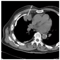 Asi 03 00008 i011 Asi 03 00008 i011