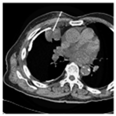 Asi 03 00008 i019 Asi 03 00008 i019