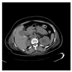 Asi 03 00008 i038 Asi 03 00008 i038