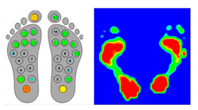 A Simple Foot Plantar Pressure Measurement Platform System Using Force ...