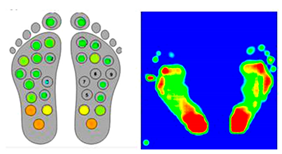 ASI | Free Full-Text | A Simple Foot Plantar Pressure Measurement ...