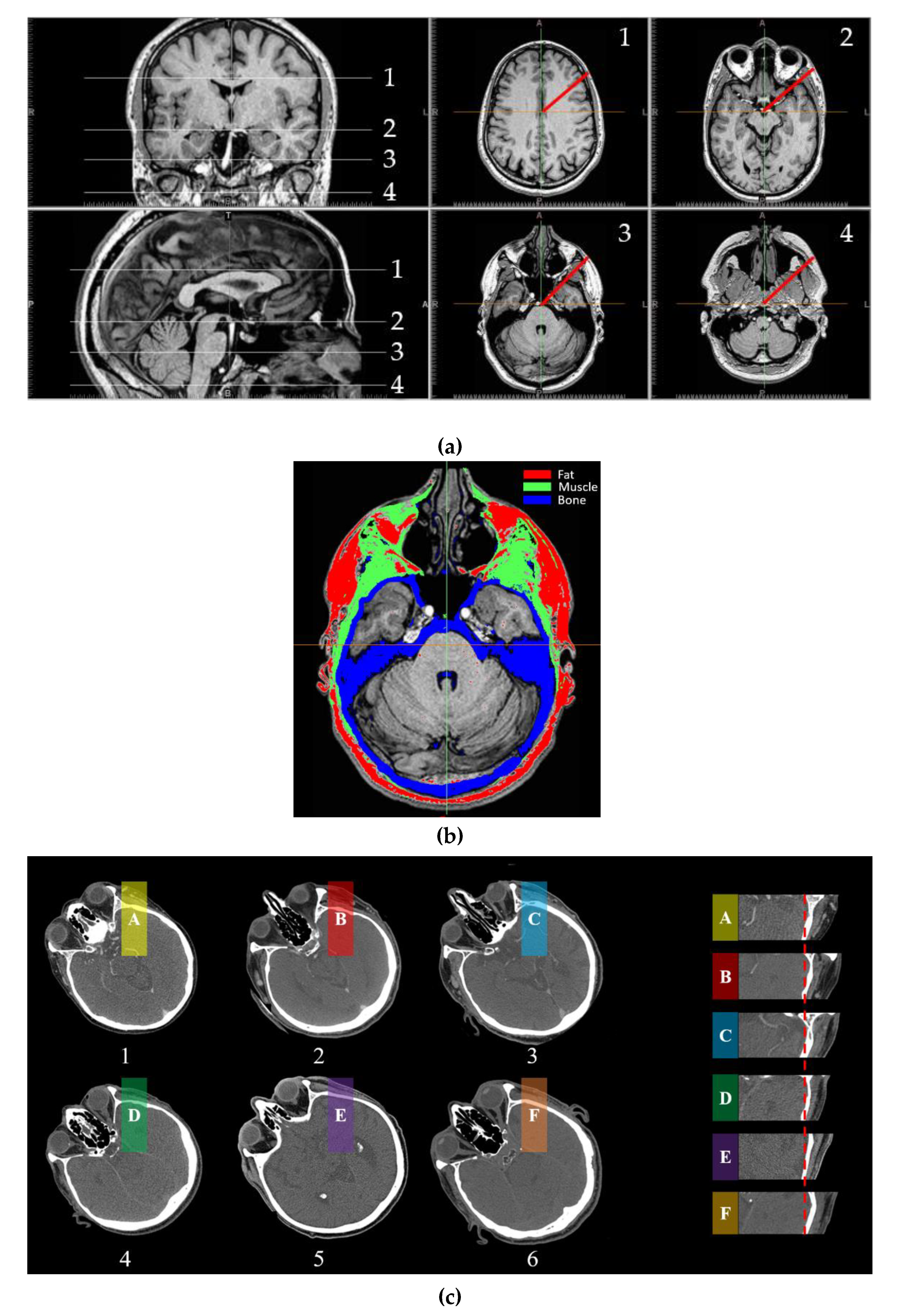 Atmosphere 11 00218 g002 Atmosphere 11 00218 g002