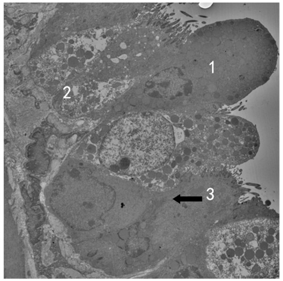 Ozone-Induced Lung and Bronchial Injury: A Mouse Model Study