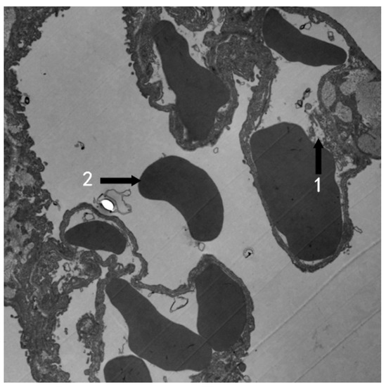 Ozone-Induced Lung and Bronchial Injury: A Mouse Model Study