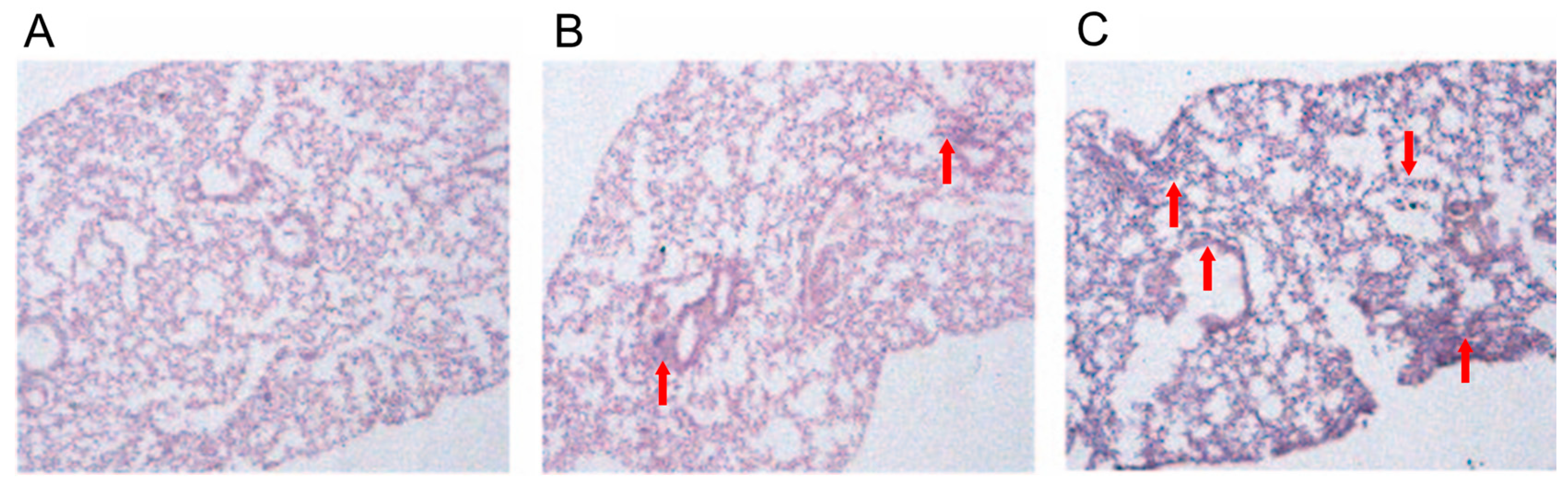 Characterization of Microbials in the Lung Induced by