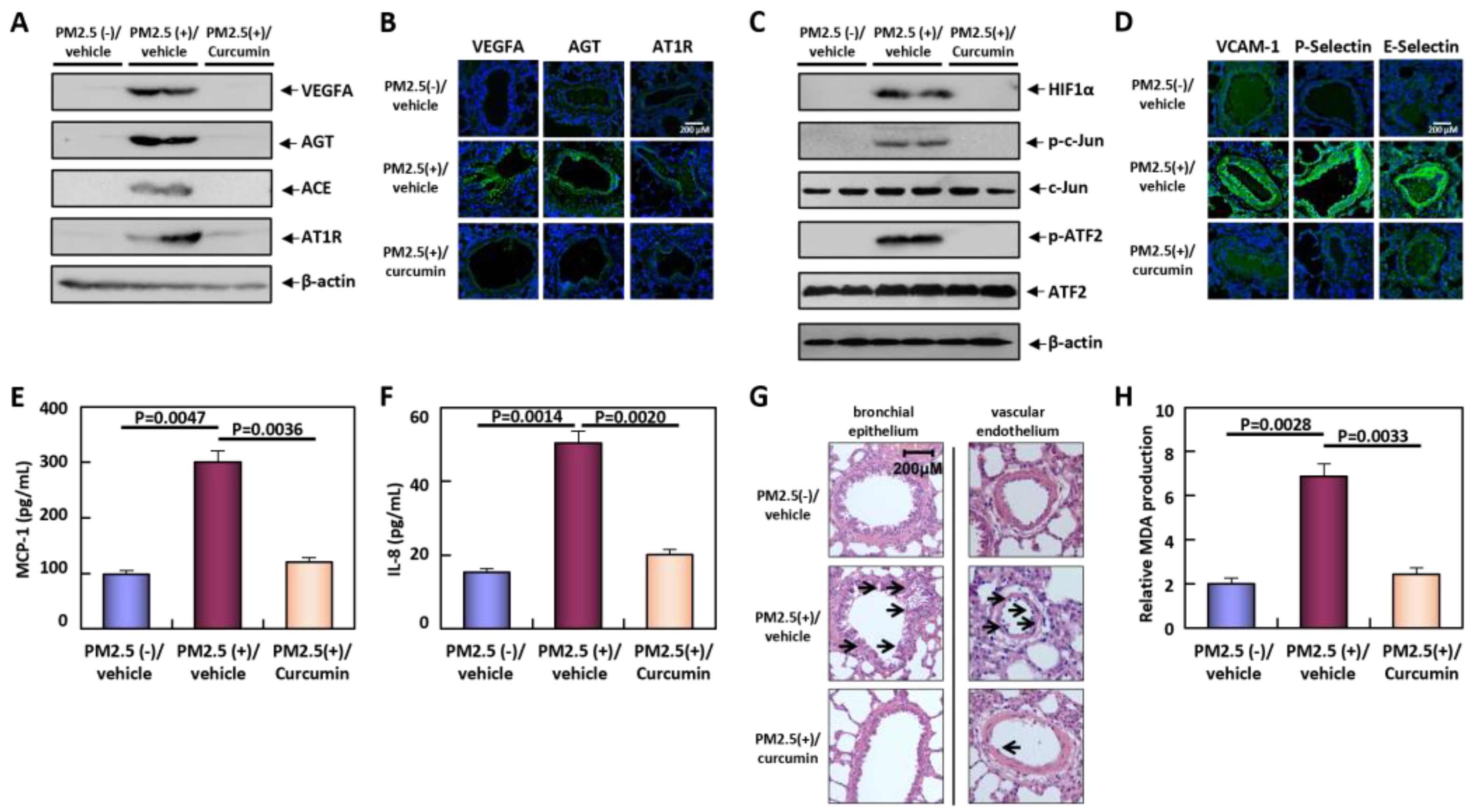 Atmosphere 15 01440 g004
