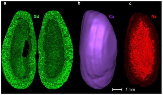 Laser-Induced Breakdown Spectroscopy in Biological Samples